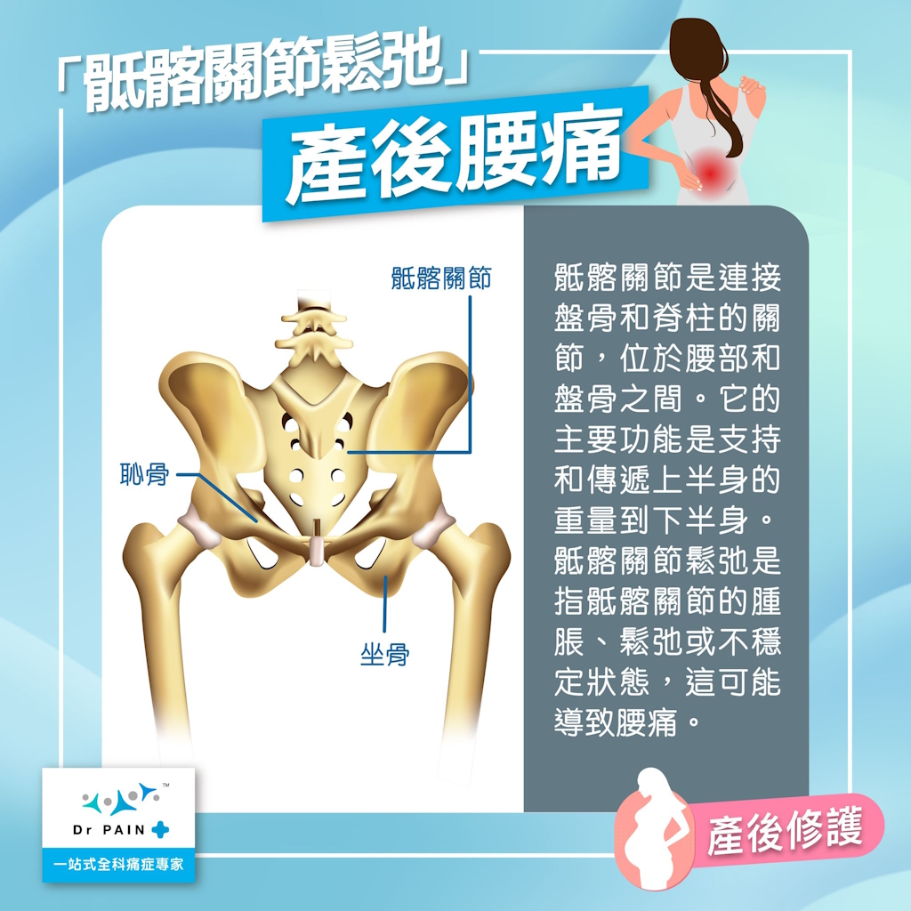 產後腰痛 骶髂關節