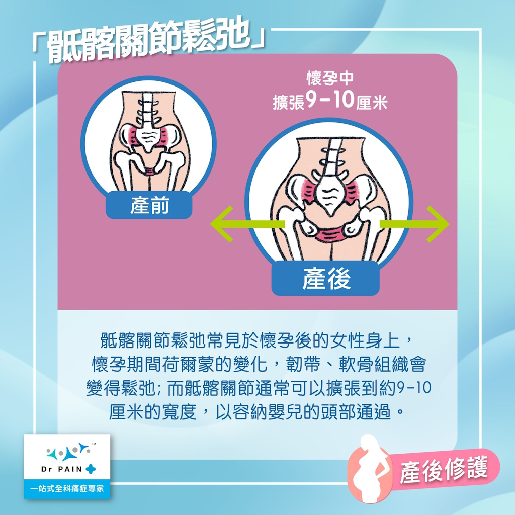 骶髂關節鬆弛