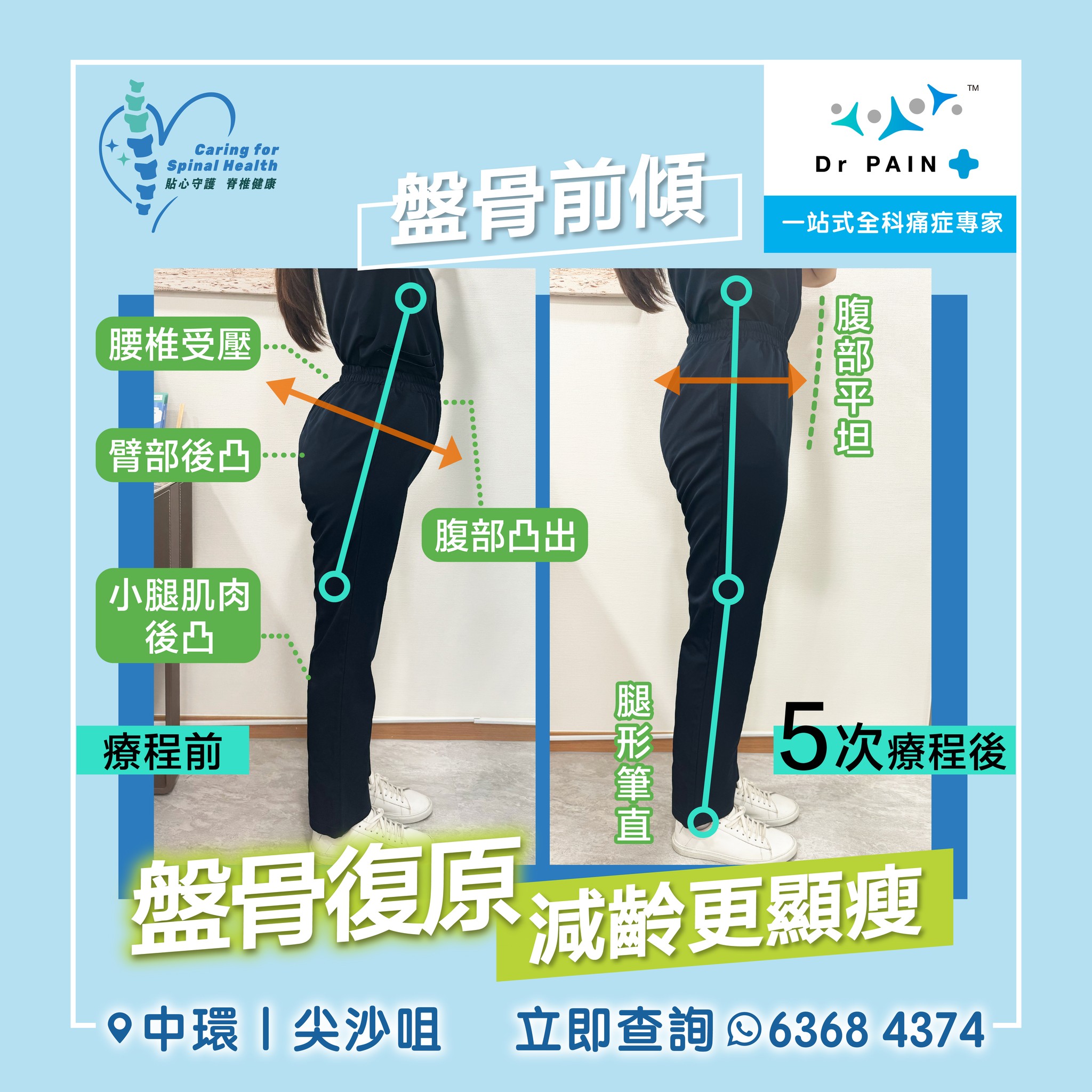 盤骨復原